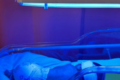 A newborn baby receiving phototherapy treatment in an incubator under blue light. Un nouveau-né recevant un traitement de photothérapie dans une couveuse sous une lumière bleue.